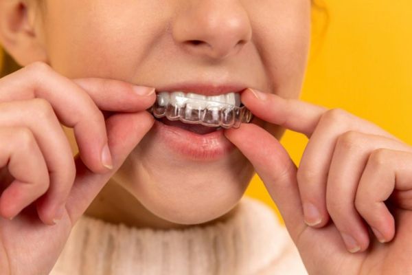 Thornhill Cosmetic Dentist - Teeth Whitening, Veneers, and Smile Makeovers